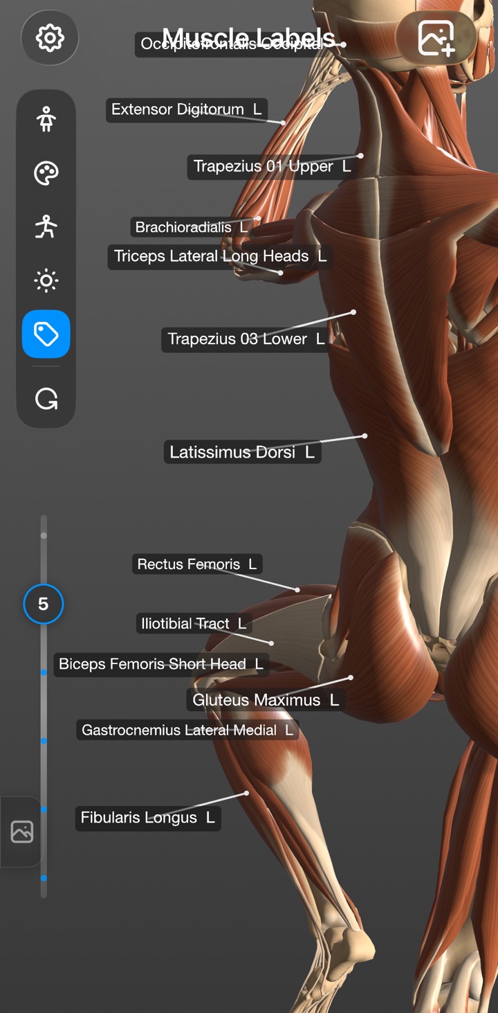 The 3D figure with anatomical labels pointing to every visible muscle