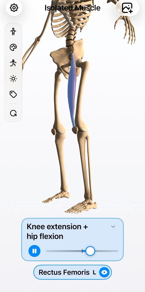 The rectus femoris moving the hip and knee as the muscle changes length